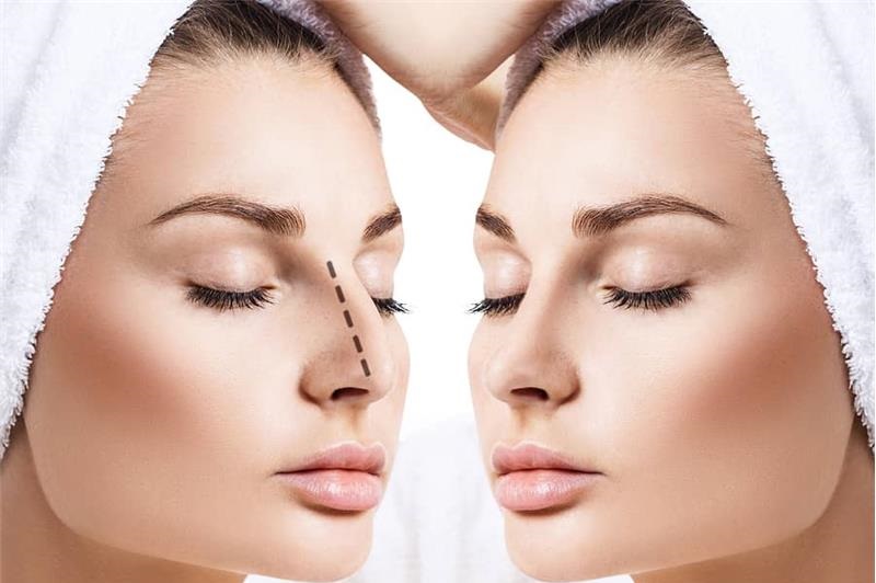 We Answered All Your Questions About Rhinoplasty