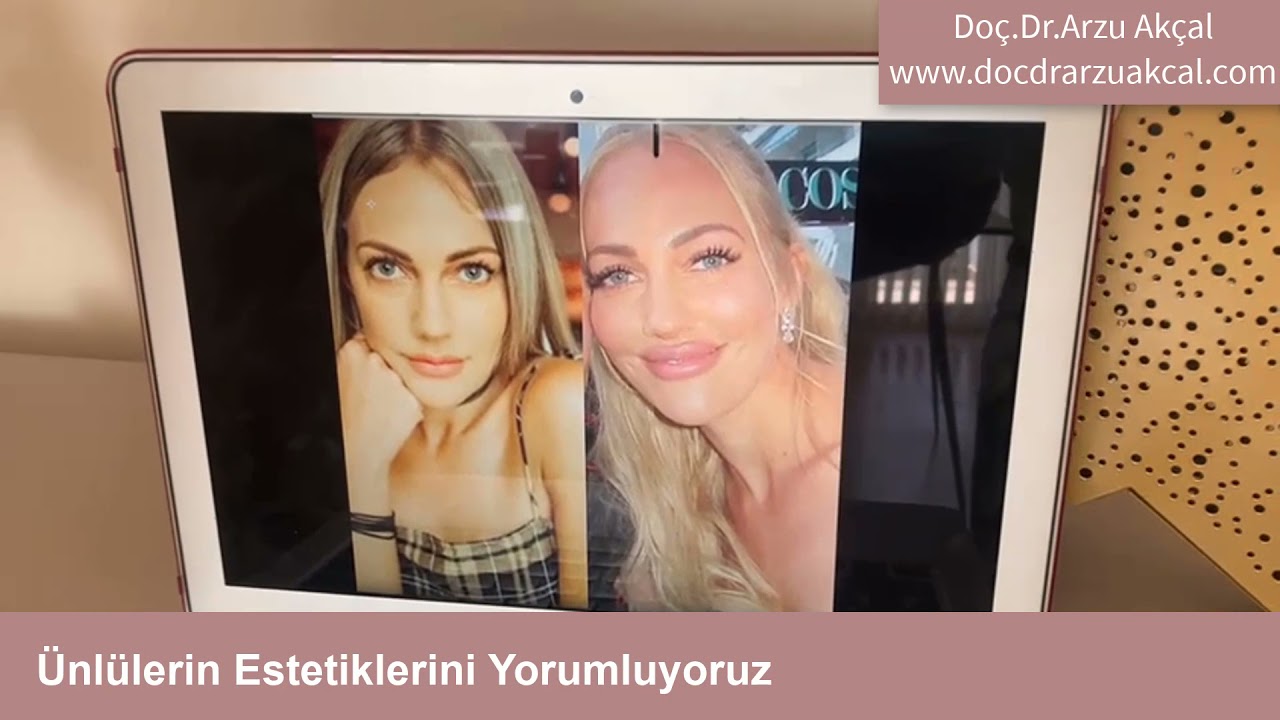 Dizi Yıldızının Yaptırdığı Estetikleri Yorumluyoruz